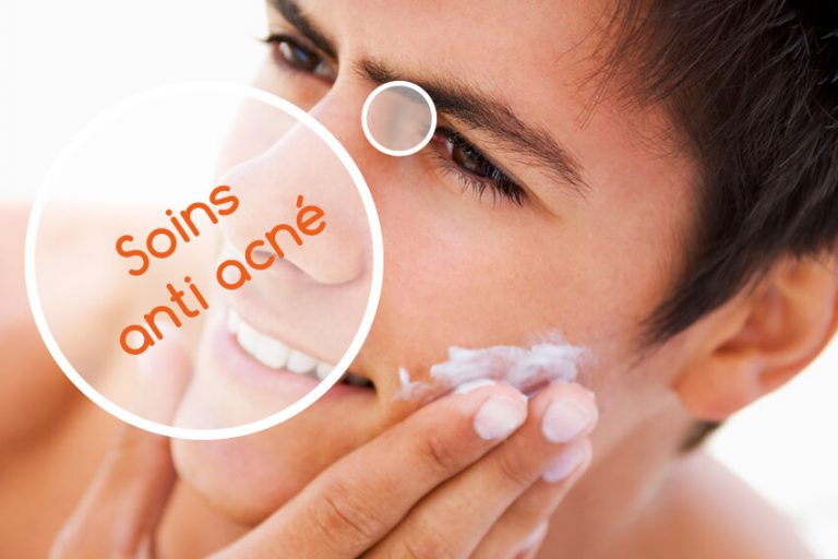 4 Soins naturels anti acné aux huiles essentielles